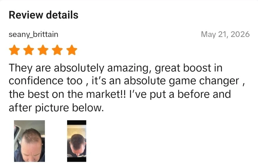 Densifol customer review from TikTok Shop