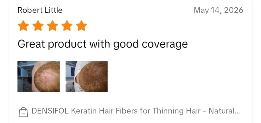 Densifol customer review from TikTok Shop