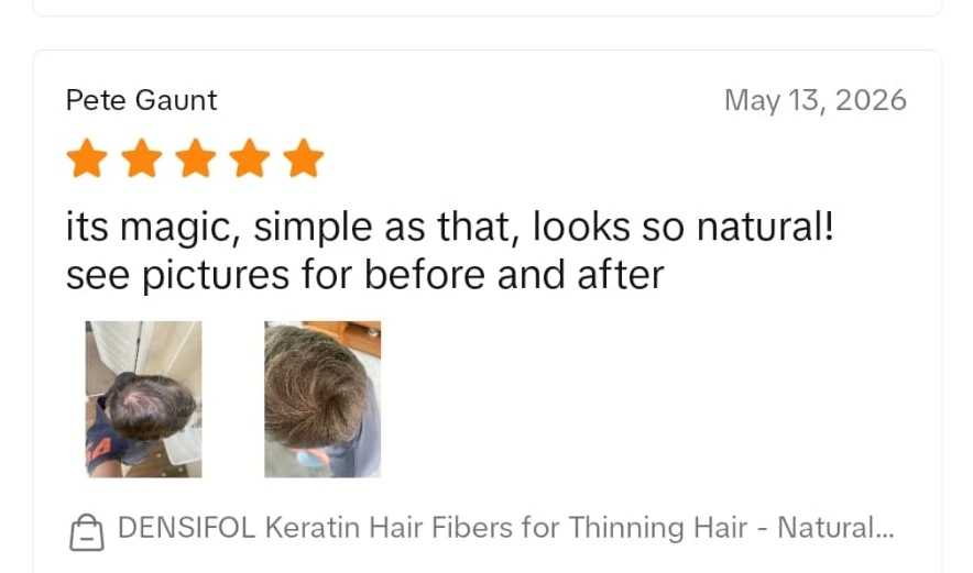 Densifol customer review from TikTok Shop