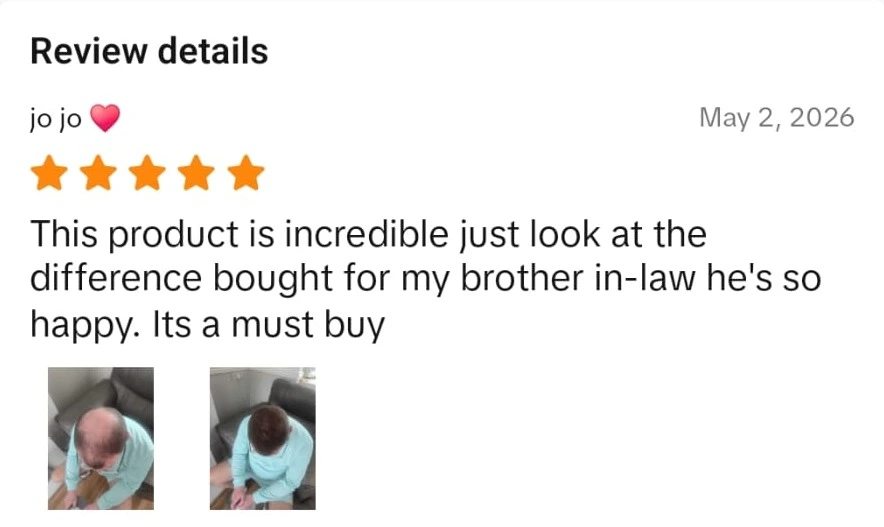 Densifol customer review from TikTok Shop